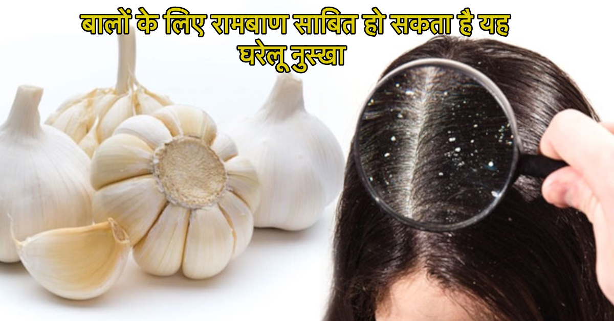 home remedy for hair