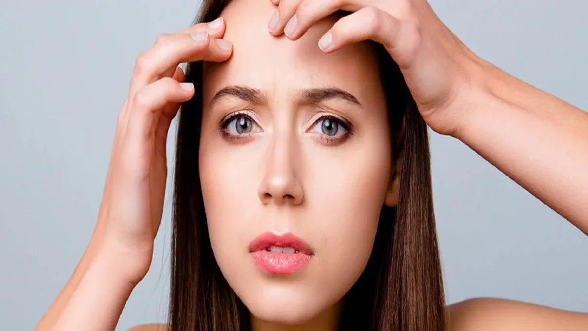 Pimples on Forehead Causes Treatment and Prevention